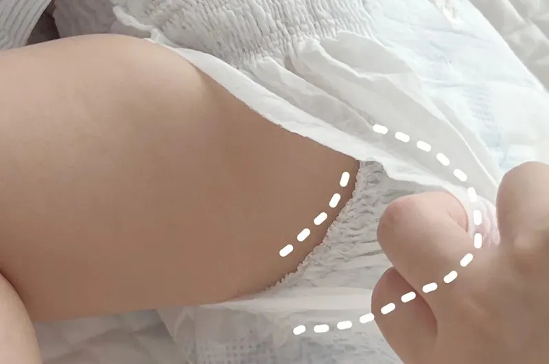 Diaper leg cuffs and 360° leak-guard around a baby’s thigh.